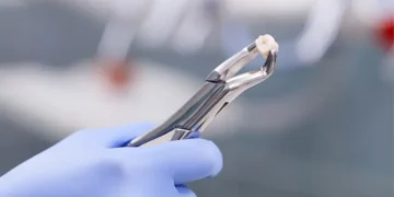 tarkusehamba eemaldamine